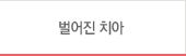 벌어진 치아